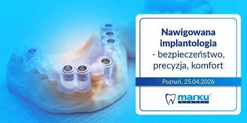 Nawigowana implantologia - bezpiecze\u0144stwo, precyzja, komfort