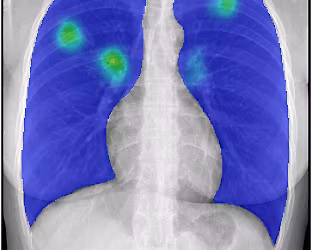 Medicine at the Crick: The Science, history and future of TB diagnostics