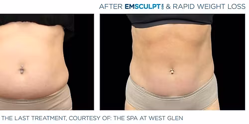 Emsculpt Neo Happy Hour Open House