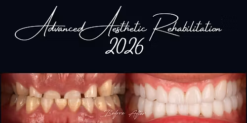 Advanced Aesthetic Rehabilitation (AAR) Sydney