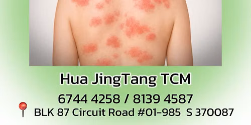 \ud83c\udf3f \u6e7f\u75b9\u95ee\u9898 \u514d\u8d39\u54a8\u8be2 \ud83c\udf3f Free Eczema Advice Session\ud83c\udf3f