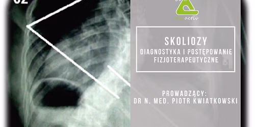 Skoliozy - diagnostyka i post\u0119powanie fizjoterapeutyczne