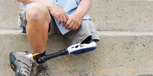 AMPED UP - Amputee Support Group