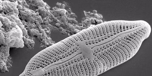 September Club Meeting: Why Diatoms Matter: How Diatoms Changed the Course of My Life.