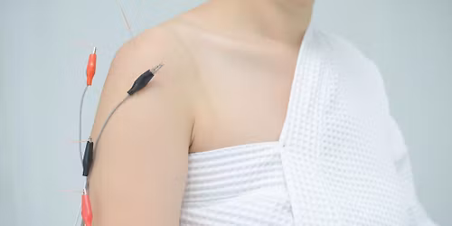 Electroacupuncture for musculoskeletal problems - with Stephen Lee [1 day CPD]