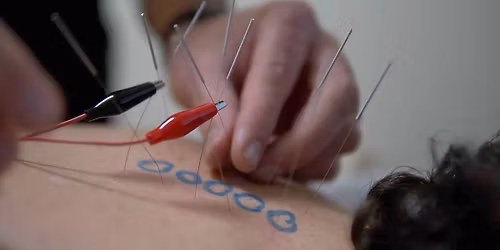 Foundations of Electroacupuncture 2-Day Seminar