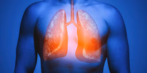 Respiratory clinical assessment skills face to face workshop for Pharmacists and Trainee Pharmacists