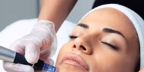 Tratamiento Especial (tiempo limitado): 2 sesiones de Dermapen + Exosomas