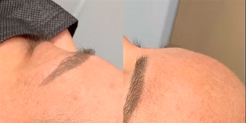 MicroBladers' Las Vegas Machine Hairline Restoration Training Workshop