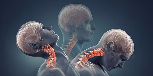 \u041a\u0430\u043c\u0448\u0438\u0447\u0435\u043d \u0443\u0434\u0430\u0440. \u041e\u0441\u0442\u0435\u043e\u043f\u0430\u0442\u0438\u0447\u0435\u043d \u043f\u043e\u0434\u0445\u043e\u0434 \u0438 \u043b\u0435\u0447\u0435\u043d\u0438\u0435