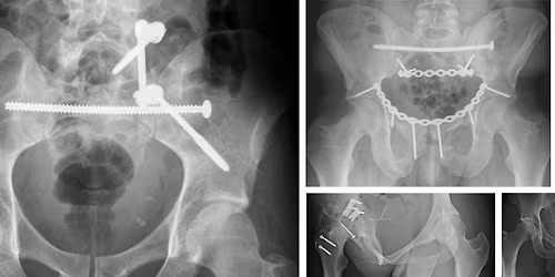 ISoPS Annual Spring Meeting