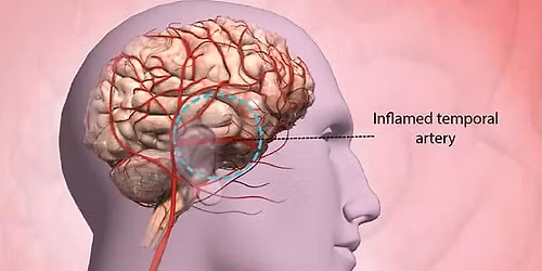 PMR\/GCA Group Support Meeting