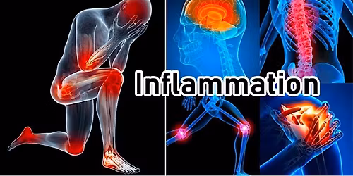 Pain and Inflammation
