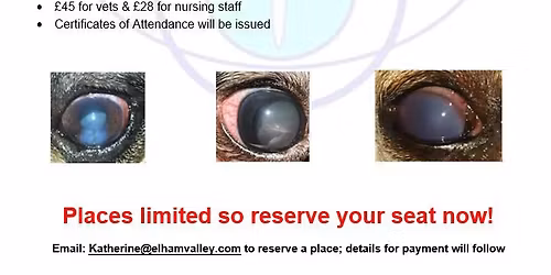 'No Pressure!' Managing Glaucoma Patients'