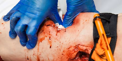 Intro to Gun shot wound medicine