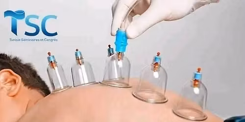 Formation technique des ventouses