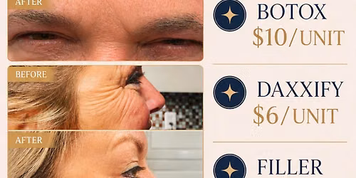 Botox Sale