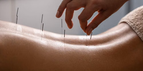 Acupuncture & Sound Bath Healing