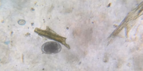 Fecal Egg Counting: Rowan County