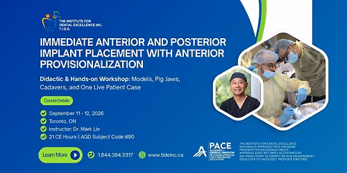 IMMEDIATE ANTERIOR AND POSTERIOR IMPLANT PLACEMENT WITH ANTERIOR PROVISIONALIZATION