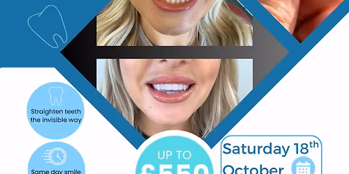 Smile Makeover 
