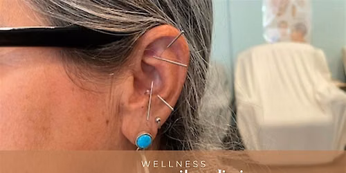 5NP Ear Acupuncture Clinic
