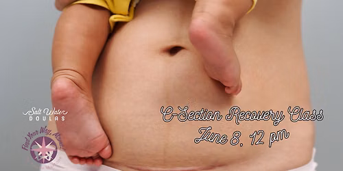 C-Section Prep & Recovery Workshop with Saltwater Doulas
