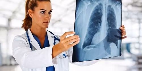 T\u00fcd\u0151sz\u0171r\u00e9s In\u00e1rcson