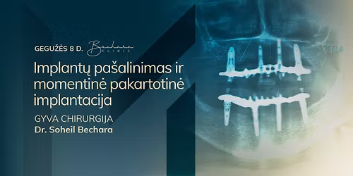 Gyva chirurgija: implant\u0173 \u0161alinimas ir pakartotin\u0117 implantacija