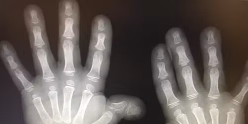 RTS Colorado summer meetup