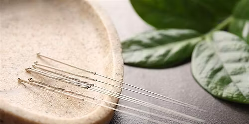 Wellbeing Ear Acupuncture