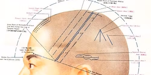 Acupuncture Avanc\u00e9e avec Pr Wang Liping
