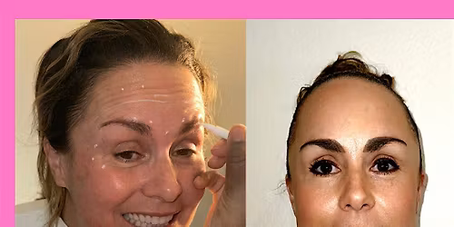 BOTOX HOLIDAY BLOWOUT