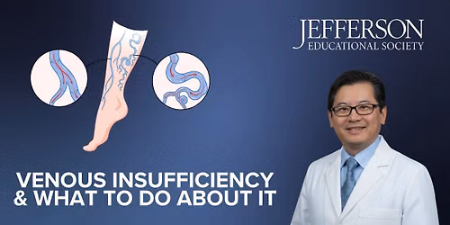 VENOUS INSUFFICIENCY & WHAT TO DO ABOUT IT