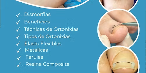 U\u00f1a encarnada - Curso Taller
