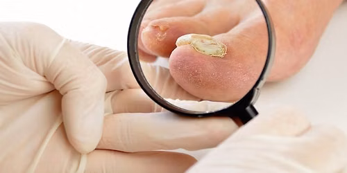 Soft Tissue & Nail Pathology - 1 Day Virtual Program - October 20, 2026