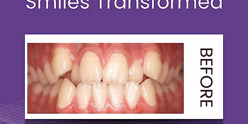 Invisalign & Facial Aesthetics Open day New Cross