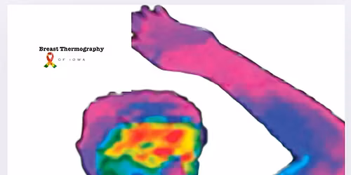 Thermography screening! 