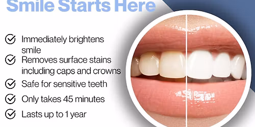 Teeth Whitening Event (Member Event)