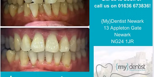 ClearCorrect teeth straightening event