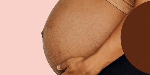 Every Pregnancy LA Launch Party