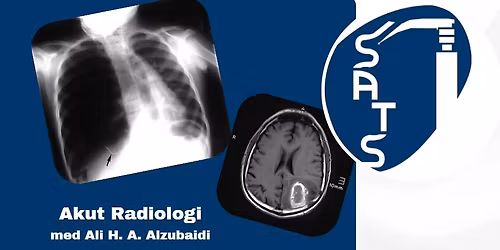 Akut radiologi
