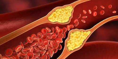 Cholesterol Unmasked: The 3 Step Approach to Restoring Your Heart Health