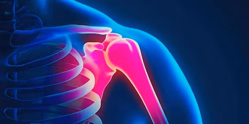 Shoulder Pain Workshop