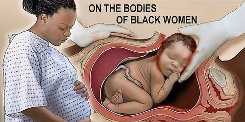 Changing the Maternity Healthcare System in Mississippi
