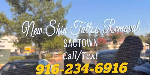 New Skin Tattoo Removal SacTown
