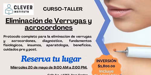 ELIMINACI\u00d3N DE VERRUGAS Curso-Taller