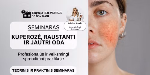 Seminaras: Kuperoz\u0117, raustanti ir jautri oda