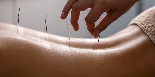 Acupuncture & Sound Bath Healing