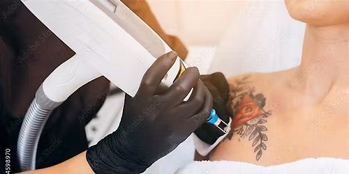 Laser Tattoo Removal Course